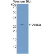 Western blot analysis of recombinant Human Nephronectin.