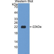 Western blot analysis of the recombinant protein.
