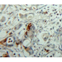Sialidase-1 (NEU1) Antibody