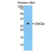 Western blot analysis of recombinant Human Neurofascin (NFASC).