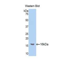 Nucleophosmin (NPM1) Antibody