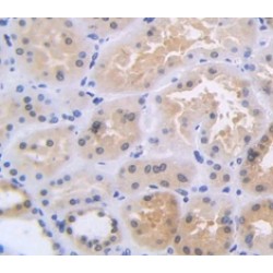 Nucleophosmin (NPM1) Antibody
