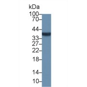 Western blot analysis of Human Jurkat cell lysate, using Human NPM Antibody (1 µg/ml) and HRP-conjugated Goat Anti-Rabbit antibody (<a href="https://www.abbexa.com/index.php?route=product/search&amp;search=abx400043" target="_blank">abx400043</a>, 0.2 µg/ml).