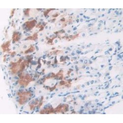 Nucleophosmin (NPM1) Antibody