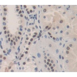Polybromo 1 (PBRM1) Antibody