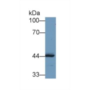 Western blot analysis of Human MCF7 cell lysate, using Rabbit Anti-Human REV1 Antibody (1 µg/ml).