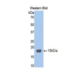 Ribophorin I (RPN1) Antibody