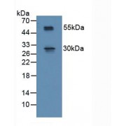 Western blot analysis of Mouse Spinal Cord Tissue.