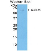 Western blot analysis of recombinant Human SULF1.