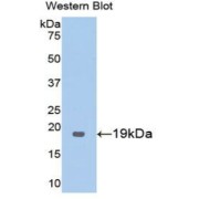 Western blot analysis of the recombinant protein.