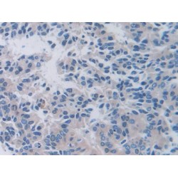 Transthyretin (TTR) Antibody