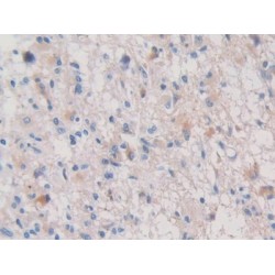 Transthyretin (TTR) Antibody