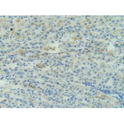 Adrenomedullin (ADM) Antibody