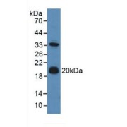 abx101056