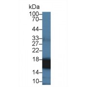 Western blot analysis of Human Liver lysate, using Human CYPA Antibody (4 µg/ml) and HRP-conjugated Goat Anti-Rabbit antibody (<a href="https://www.abbexa.com/index.php?route=product/search&amp;search=abx400043" target="_blank">abx400043</a>, 0.2 µg/ml).