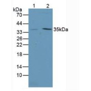 Western blot analysis of (1) Mouse Intestine Tissue and (2) Mouse Stomach Tissue.