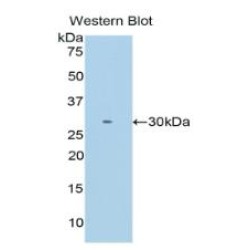 Intelectin 1 (ITLN1) Antibody
