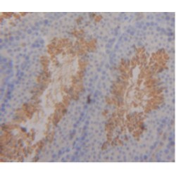 Intelectin 1 (ITLN1) Antibody
