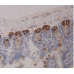 Intelectin 1 (ITLN1) Antibody