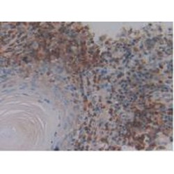 Neuropeptide Y (NPY) Antibody