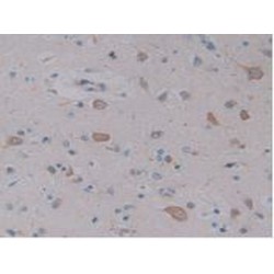 Neuropeptide Y (NPY) Antibody