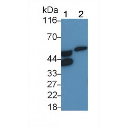 Alpha-1-Acid Glycoprotein 2 (ORM2) Antibody