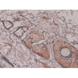 Pronociceptin (PNOC) Antibody