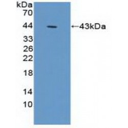 Actin Gamma 1 (ACTg1) Antibody
