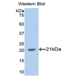 Spectrin Alpha Chain, Non-Erythrocytic 1 (SPTAN1) Antibody
