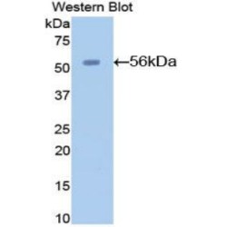 Angiotensinogen (AGT) Antibody