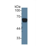 Western blot analysis of Rat Serum, using Rat AGT Antibody (1 µg/ml) and HRP-conjugated Goat Anti-Rabbit antibody (<a href="https://www.abbexa.com/index.php?route=product/search&amp;search=abx400043" target="_blank">abx400043</a>, 0.2 µg/ml).
