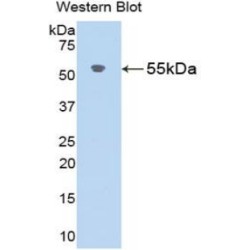 Angiotensinogen (AGT) Antibody