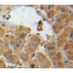 Angiotensinogen (AGT) Antibody