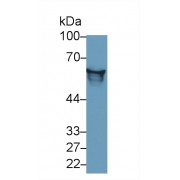 Western blot analysis of Rat Serum, using Rat AGT Antibody (3 µg/ml) and HRP-conjugated Goat Anti-Mouse antibody (<a href="https://www.abbexa.com/index.php?route=product/search&amp;search=abx400001" target="_blank">abx400001</a>, 0.2 µg/ml).