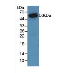 Angiotensinogen (AGT) Antibody