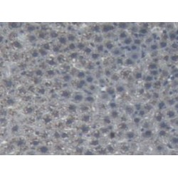 Angiotensinogen (AGT) Antibody