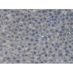 Angiotensinogen (AGT) Antibody