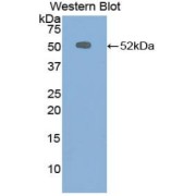 Western blot analysis of the recombinant protein.