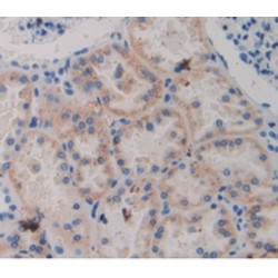 Amine Oxidase Copper Containing 1 (AOC1) Antibody