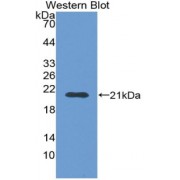 Western blot analysis of recombinant Human DAO.