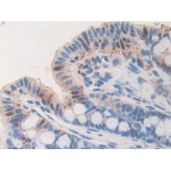 Fibrinogen Beta (FGB) Antibody