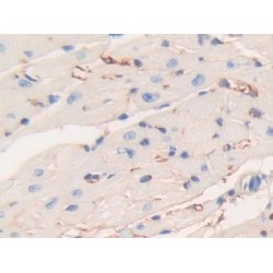 Fibrinogen Beta (FGB) Antibody