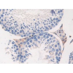 Fibrinogen Beta (FGB) Antibody