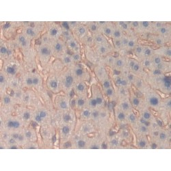 Fibrinogen Beta (FGB) Antibody