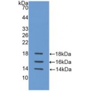 Western blot analysis of recombinant Human IL15.