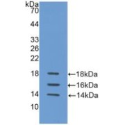 abx101178