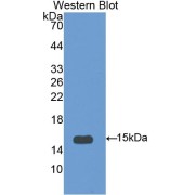 Western blot analysis of the recombinant protein.