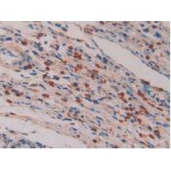 Interleukin 16 (IL16) Antibody