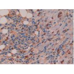 Interleukin 16 (IL16) Antibody