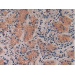 Interleukin 16 (IL16) Antibody